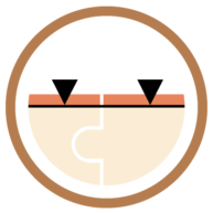 Versiegelungen